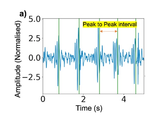 Heart Rate Extraction from Abdominal Audio Signals teaser figure
