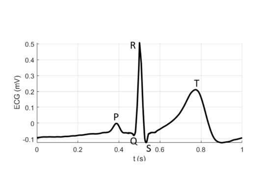 Ear-ECG Denoising Using Heart Sounds and the Extended Kalman Filter teaser figure