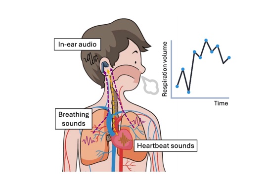 EarMeter: Continuous Respiration Volume Monitoring with Earables teaser figure