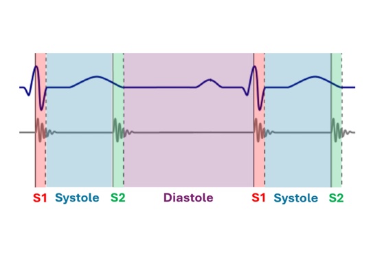 Deep-Learning Based Segmentation of In-Ear Cardiac Sounds teaser figure